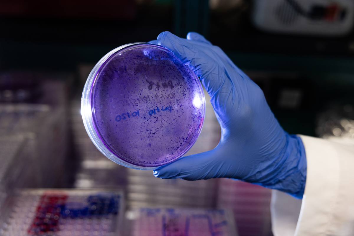 Cultured cancer cells help student and faculty researchers unlock the puzzle of drug resistance and potential therapy pathways in Daniel Chen’s cancer research lab. Photo by Chase Reynolds